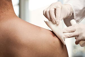 soins-postchirurgie